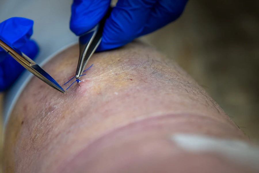 Precision Veterinary Sutures for Reliable Wound Closure